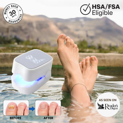 Nail Fungus Laser